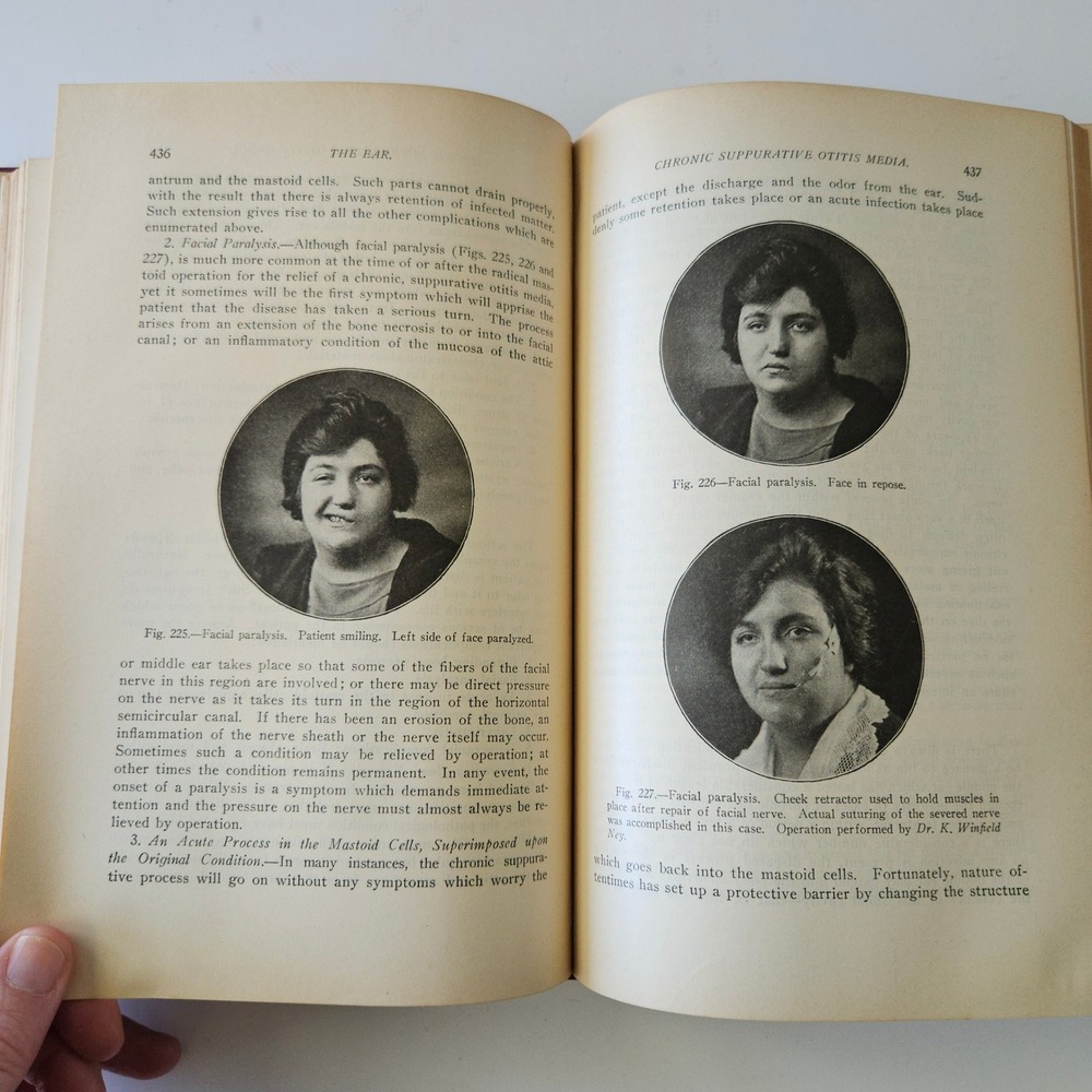 Diseases of the Ear Nose and Throat by Harold Hays 1926 HC Color Illustrations - Picture 9 of 11